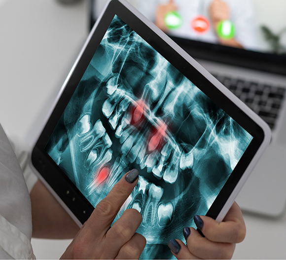 Dentist looking at an x-ray of a patient's teeth