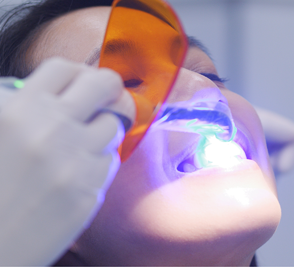 Woman getting her tooth treated with an ultraviolet light