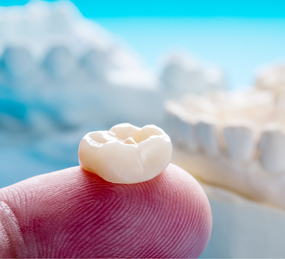 Close up of a dental crown resting on a finger