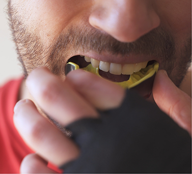 Man placing a mouthguard over his teeth