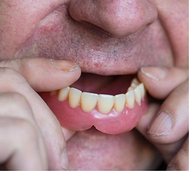 Close up of a man placing a denture into his mouth