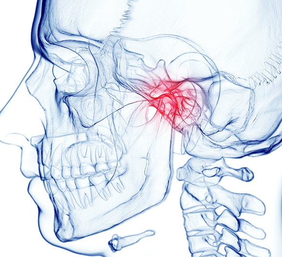 Illustrated x-ray with the jaw joint highlighted
