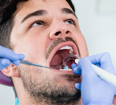 Man getting a dental cleaning
