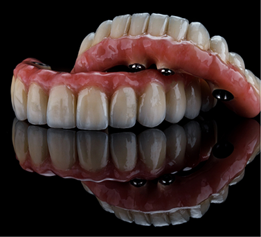 Set of implant dentures