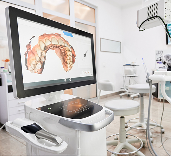 Monitor showing digital impressions of a patient's teeth