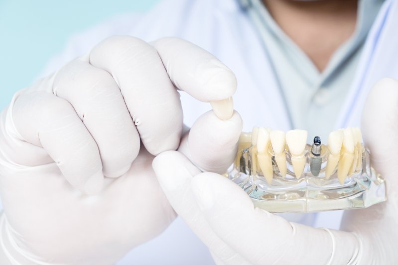 Close-up of hands holding model with dental implants and restorations.