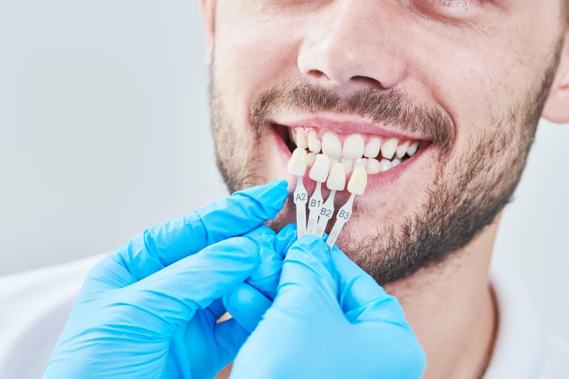 A dentist holding up color matching tools to a patient's teeth.