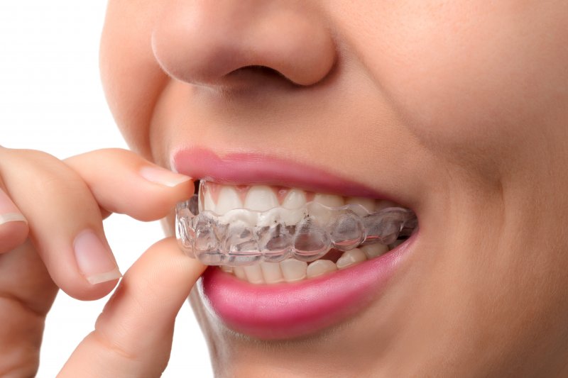Patient smiling as they remove their clear aligners